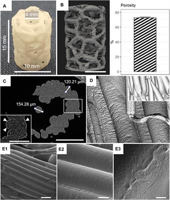 In vivo characterization of 3D-printed polycaprolactone-hydroxyapatite scaffolds with Voronoi design to advance the concept of scaffold-guided bone regeneration